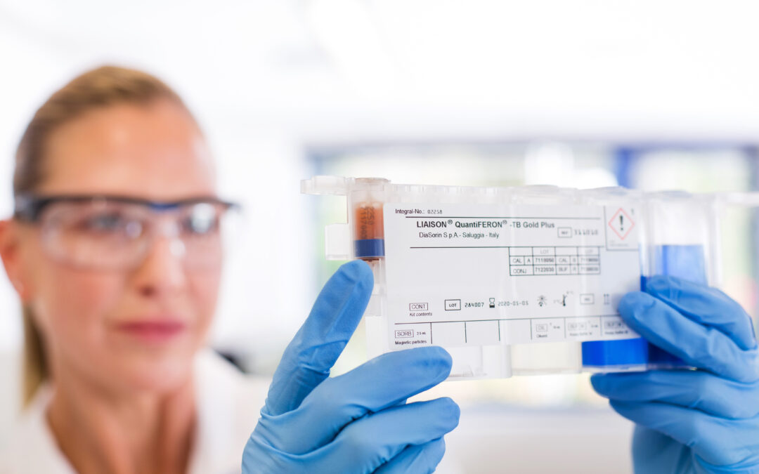 Tuberculose: a importância da solução LIAISON® QuantiFERON® TB-Gold Plus