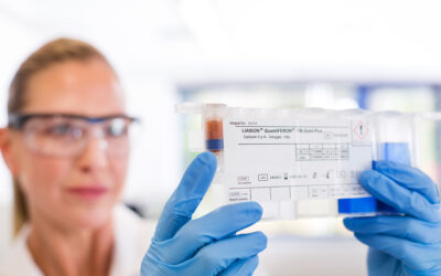 Tuberculose: a importância da solução LIAISON® QuantiFERON® TB-Gold Plus