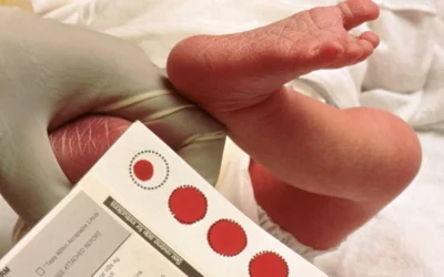 OMS faz chamado para ampliação do teste do pezinho e SBTEIM reforça cinco prioridades para a Triagem Neonatal brasileira