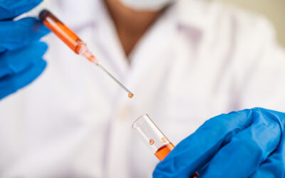 Biópsia líquida: o exame de sangue que pode transformar a investigação do câncer